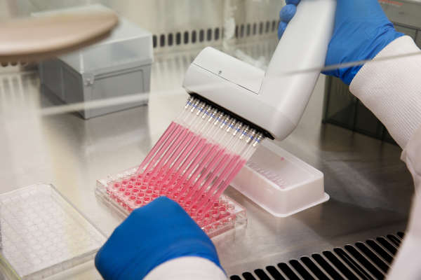 The pharmaceutical industry faces significantly longer lead times than other industries, and time delays can seriously impact the health outcomes of countless individuals. Recognizing the potential risks this poses, one industry giant sought to improve on-time delivery through an early warning system.